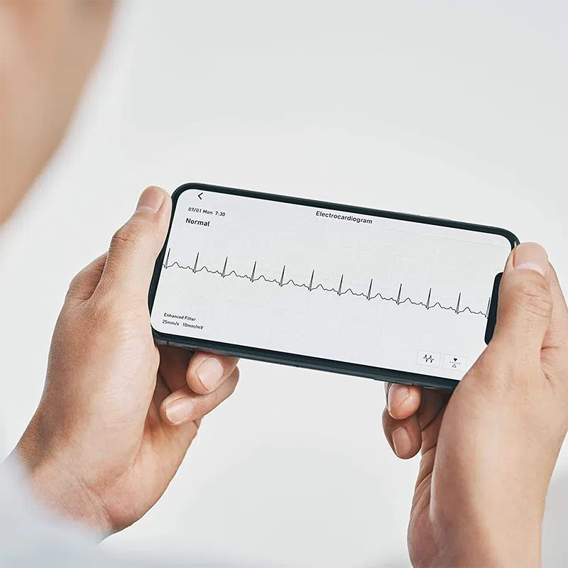 EKG-kurva på din mobil